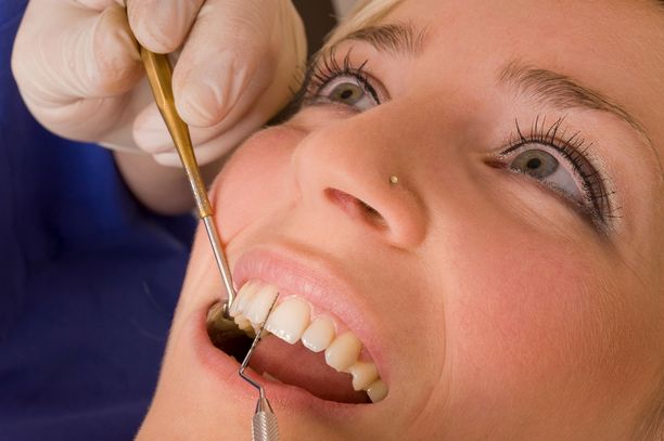 Parodontiitti voi olla oireeton. Siksi säännölliset hammaslääkärikäynnit ovat tärkeitä.