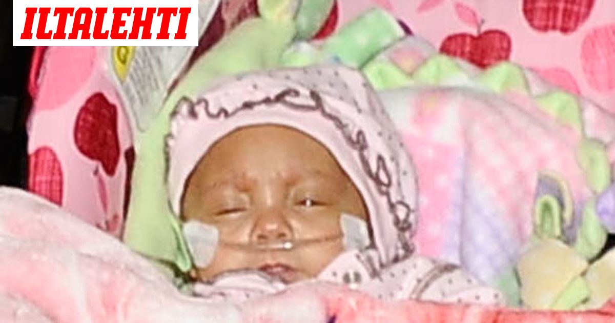 Maailman pienimpiin lukeutuva keskonen pääsi kotiin