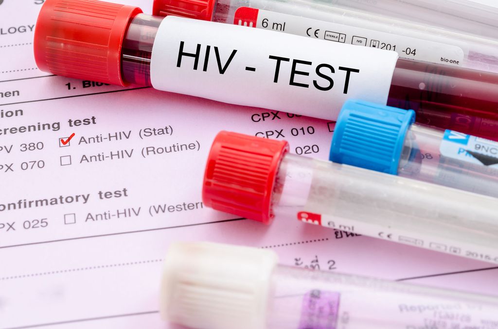 HIV-rokotetta annetaan jo potilaille – perustuu samaan mRNA-tekniikkaan kuin korona­rokotteet