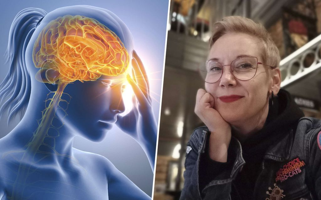 Neurologi suositteli Sandylle migreeniin erikoista hoitokeinoa ja se tepsi – Professori: Ei voi mitenkään suositella