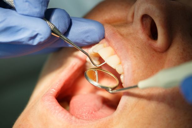 Hoitamaton suu voi altistaa monille vakaville sairauksille.