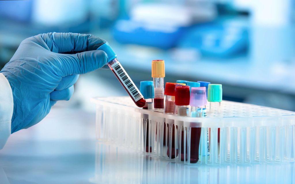 Suomessa käyttöön uusi verikoe – Voi muuttaa monen elämän