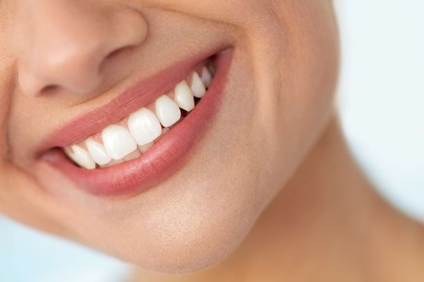 Uutuusmenetelmä ei tähtää hampaiden valkaisuun, mutta se saattaa poistaa myös jotain värjäytymiä.