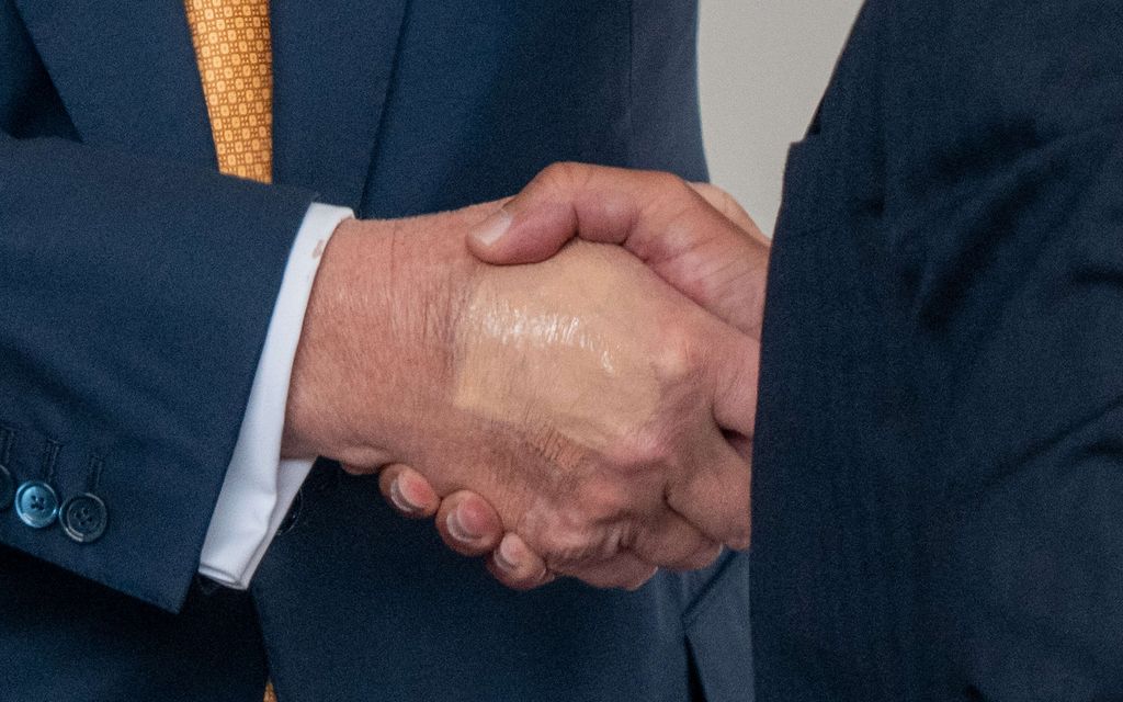 Donald Trumpin käsi herättää huomiota