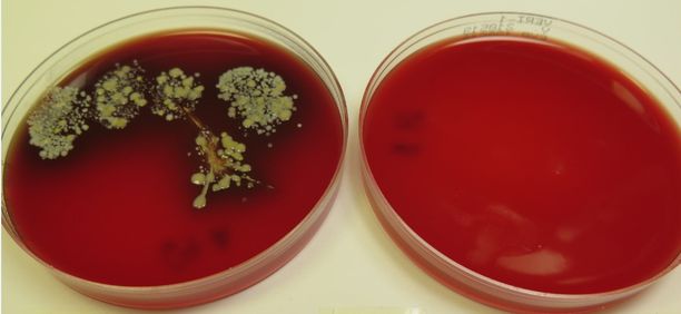 Vasemmalla mikrobeja pesemättömistä käsistä, oikealla käsidesikäsittelyn jälkeen.
