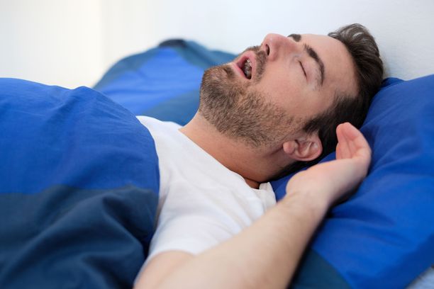 Usein kuorsaaminen on se oire, joka vie uniapneapotilaan kysymään neuvoa lääkäriltä.