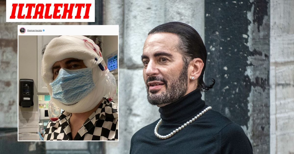 Marc Jacobs kävi kasvojenkohotuksessa: kuvat