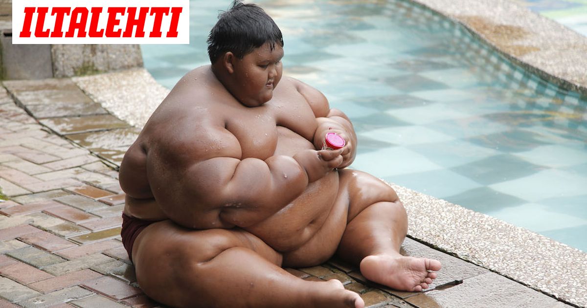 Maailman lihavin lapsi pääsi laihdutusleikkaukseen - 11-vuotias  indonesialaispoika painoi pahimmillaan 192 kiloa