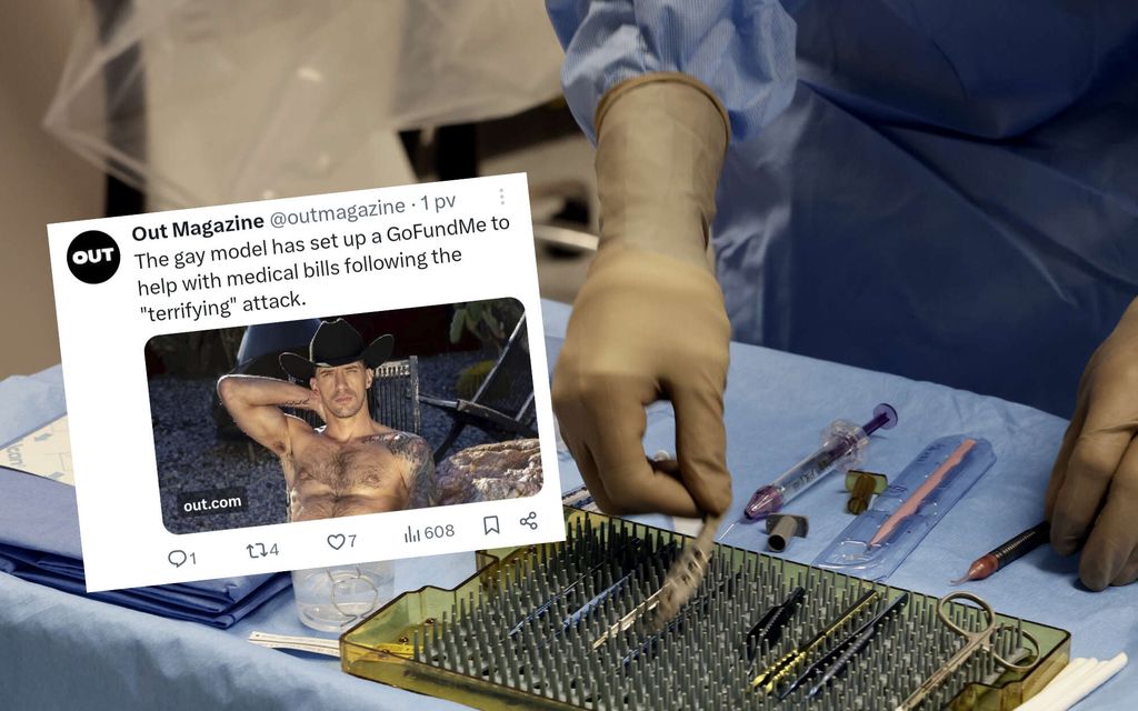 Pornotähteä puukotettiin