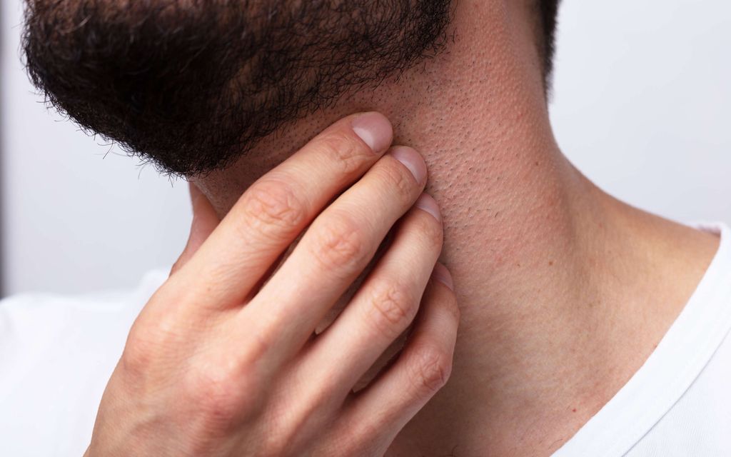 Oireena usein pelkkä patti – Voi kertoa vakavasta sairaudesta