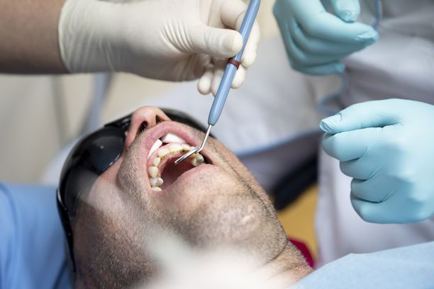 Ruotsin Smoolannissa on ilmennyt valtion hammashoidon tuen väärinkäytöksiä. Kuvituskuva.