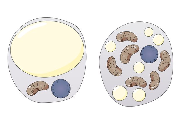 Vasemmalla on kaavakuva valkoisen rasvan solusta, oikealla ruskean rasvan solu. Ruskean rasvan solussa on paljon mitokondrioita.