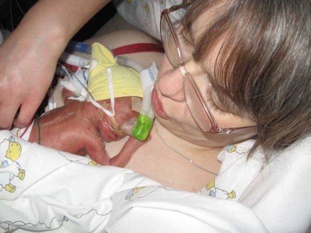Taina kiidätettiin hätäsektioon, kun Jonni-vauva syntyi liian aikaisin -  verenluovutus pelasti sekä lapsen että äidin hengen