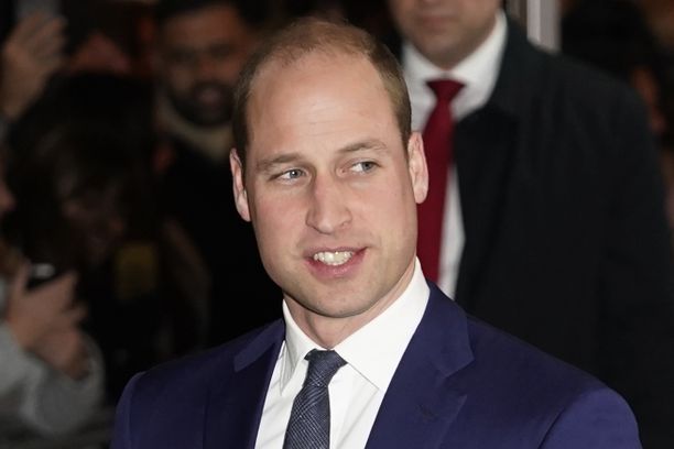 Kosmeettista kirurgiaa tarjoava yritys nimesi prinssi Williamin maailman seksikkäimmäksi kaljuksi mieheksi.