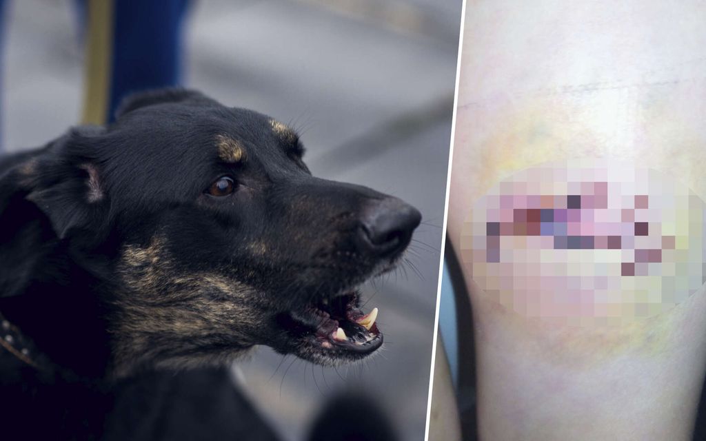 Koira hyökkäsi pikkupojan kimppuun – Kuva voi järkyttää