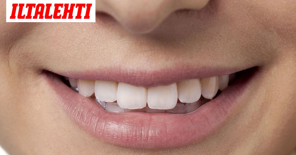 7 Kikkaa Valkaista Hampaita Luonnollisesti