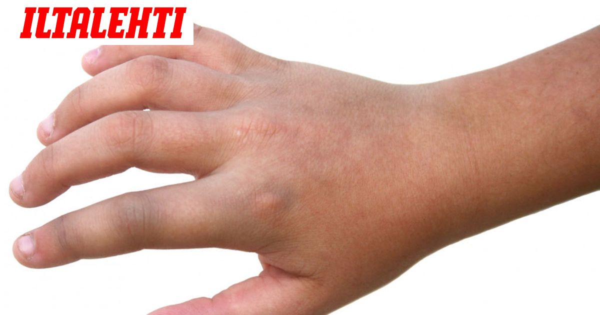 7 Asiaa Jotka Turvottavat Sormia