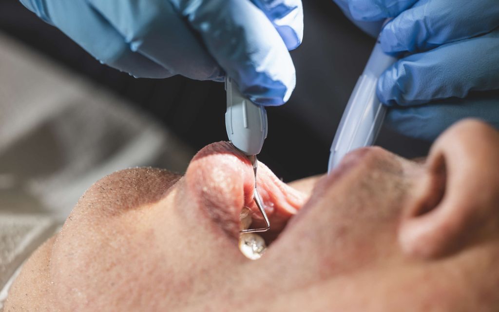 Oletko menossa hammashoitoon? Älä mene halpaan