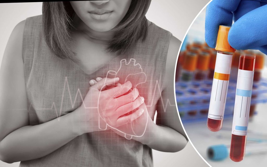 Puoli miljoonaa suomalaista kantaa riskigeeniä – Erikoislääkäri suosittelee testiä