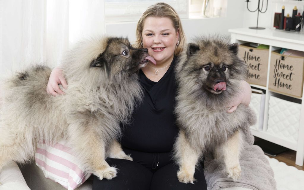 Jennalla, 25, on sairaus, joka pilaa vaatteet – Iholle ilmestyy märkiviä, helvetil­lisesti polttelevia patteja