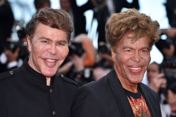 Igor ja Grichka Bogdanoffin ulkonäkö kohahdutti Cannesin punaisella matolla vuonna 2018.
