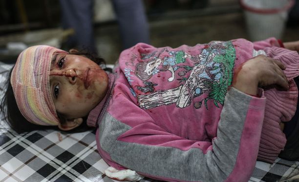 Pommi-iskussa vahingoittunut lapsi sai hoitoa Syyriassa helmikuussa 2017.