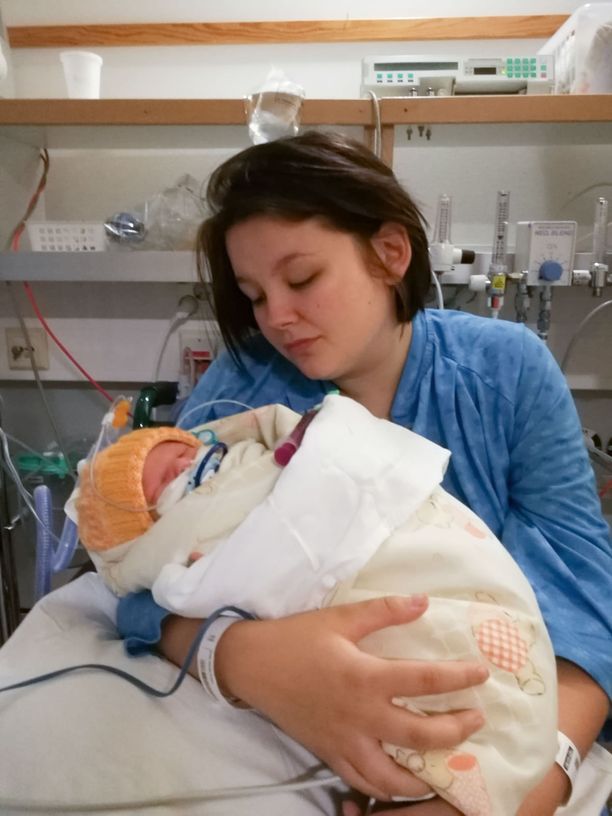 Ronja, 19, ahdistui uusperheen ristipaineessa - sitten vauvalta löytyi  harvinainen sydänvika ”Lääkärit eivät osaa antaa ennustetta vauvan  selviämisestä koska näitä tapauksia ei ole”