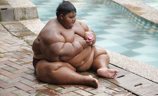 Maailman lihavin lapsi pääsi laihdutusleikkaukseen - 11-vuotias  indonesialaispoika painoi pahimmillaan 192 kiloa