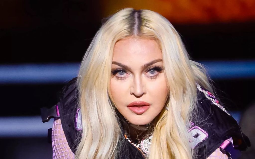 ”Kuka on muokannut kasvosi?” – Madonnan uusi kuva hämmentää