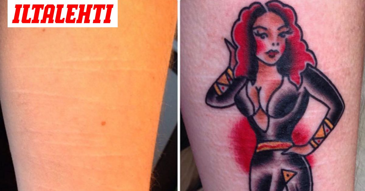 Tatuoija piilottaa viiltelyarvet ilmaiseksi