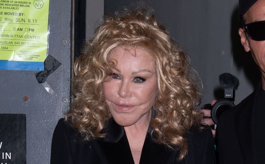 Muistatko hurjasti muuttuneen Jocelyn Wildensteinin?