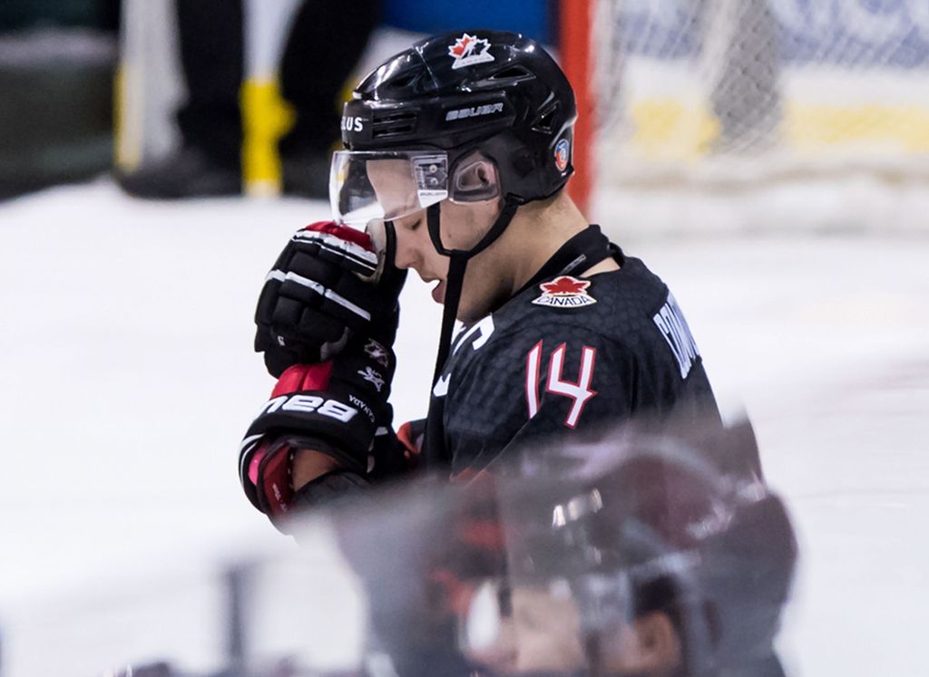 NHL-seura paljasti: Suomen voiton jälkeen valtavan lokamyrskyn kohteeksi joutunut kanadalaiskapteeni pelasikin loukkaantuneena