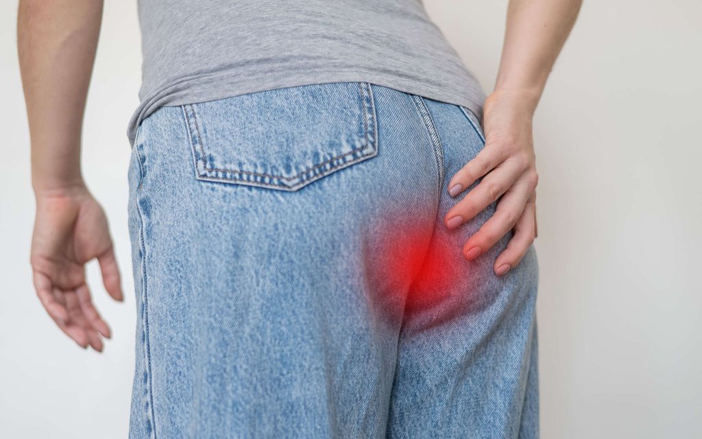 Viiltävä kipu iskee yhtäkkiä takapuoleen – Tästä on kyse