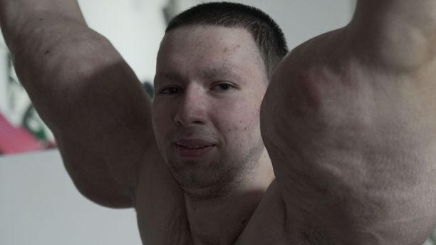 Kirill Tereshin nousi julkisuuteen, kun käsivarret paisuivat muodottomiksi. 