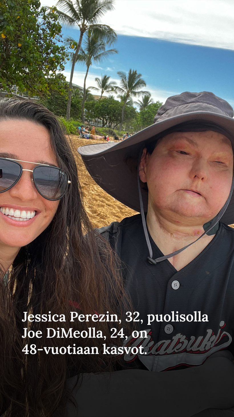 joe-24-paloi-onnettomuudessa-pahasti-nyt-h-nell-on-48-vuotiaan