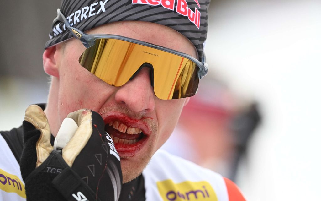 Iivo Niskasta kyykytettiin: ”Hyvältä tuntuu”