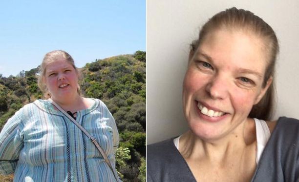 Sarin, 37, laihdutus laukaisi anoreksian - 