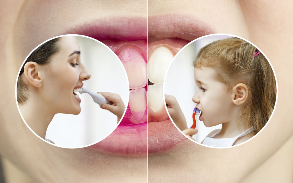 Sähköharja vai sittenkin se perinteinen hammasharja? Suuhygienisti neuvoo, mikä ratkaisee