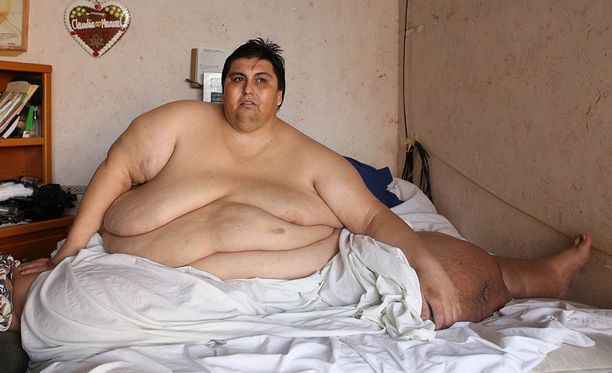 Maailman lihavin mies menetti tittelinsä - laihdutti 175 kiloa