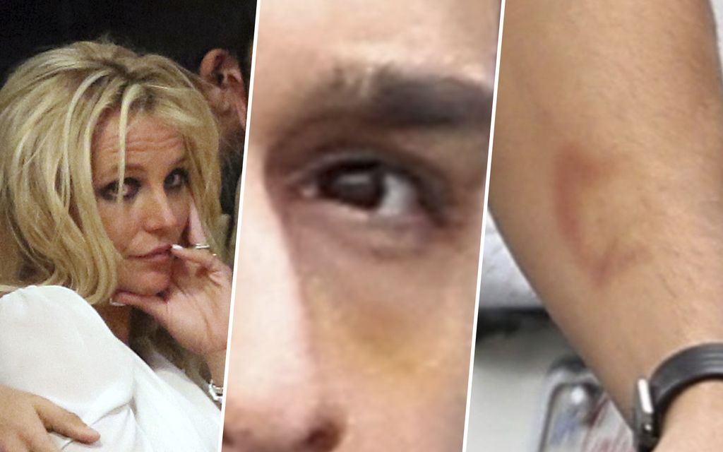 Huhumylly kiihtyy: Pahoinpitelikö Britney ex-kumppaniaan?