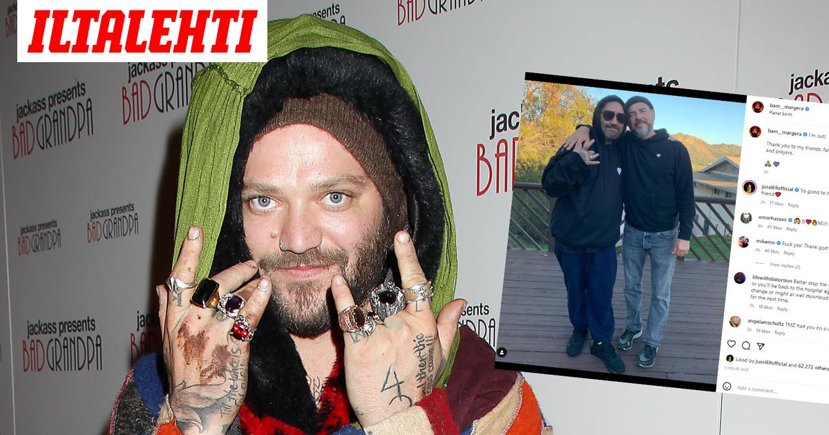 Bam Margera kertoo kuvapäivityksellä voinnistaan