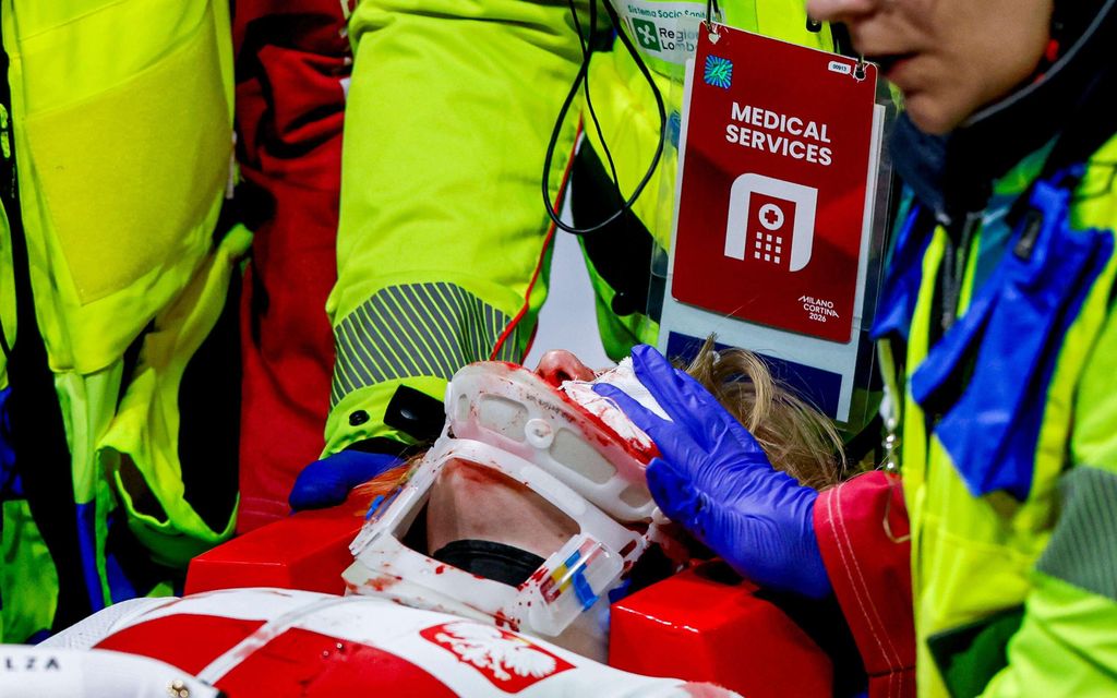 Pikaluistelija joutui karmeaan onnettomuuteen – Tältä hän näyttää nyt