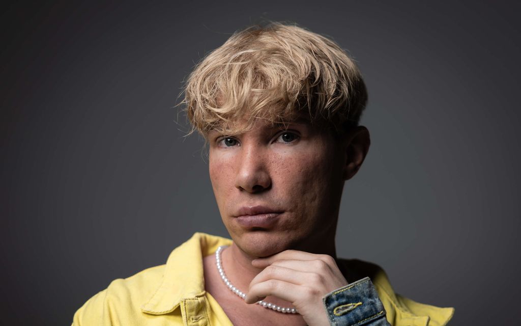 Joni Hesselgren lähti Etelä-Koreaan kauneus­leikkaukseen – Klinikalla ”Doctor Kim” lausui hävyttömät sanat