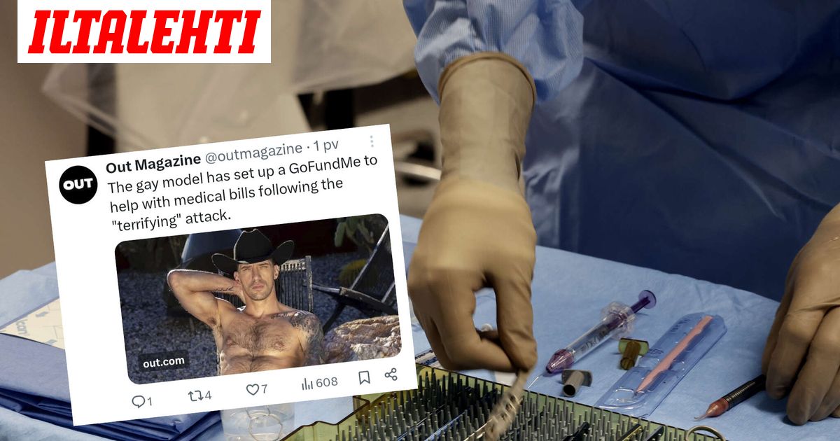 Pornotähden kimppuun hyökättiin – Julkaisi rajun kuvan