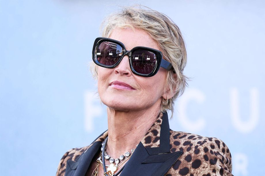 Actress Sharon Stone’s Black Eye Worried Fans – Now Explains What Happened
 – 2024-08-04 13:00:20