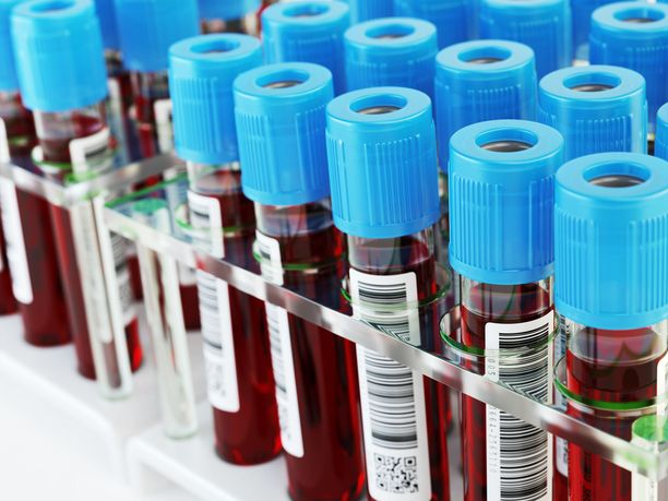 Miten verikoetuloksia tulkitaan?