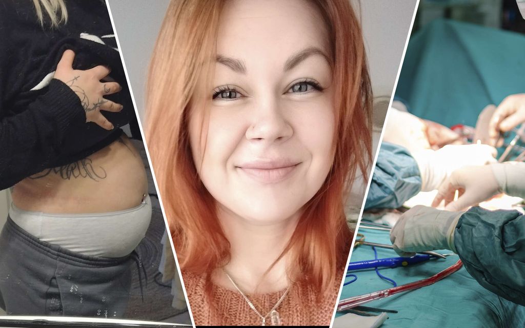 Sanna-Maria kärsi vuosia kivuista ja turvotuksesta, joka aiheutti hänelle ”raskausmahan” – Lääkärit eivät keksineet syytä