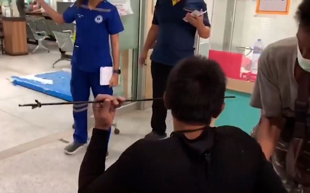 Thaimaalais­kalastaja vietiin sairaalaan nuoli kasvoissa – vahinkolaukaus harppuunan kanssa sai aikaan järkyttävää jälkeä 