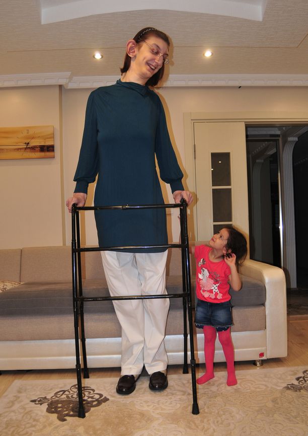 Rumeysa Gelgi, 24, on nyt maailman pisin nainen